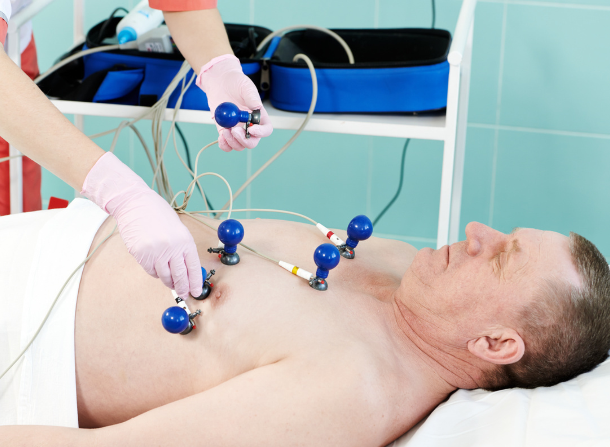 Eletrocardiograma